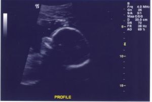 ultrasound10.jpg