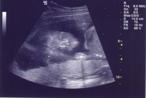 ultrasound4.jpg