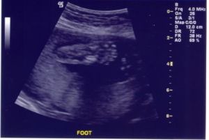 ultrasound6.jpg