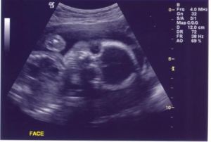 ultrasound9.jpg